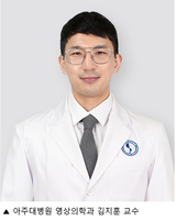 간세포암 TACE(색전술) 효과와 안전성 확인
